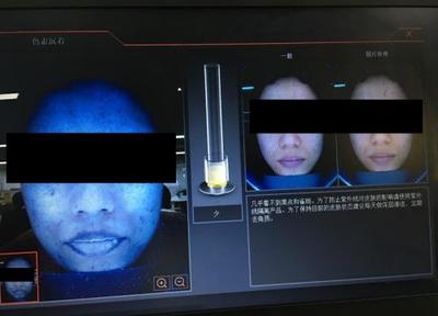 皮肤检测仪深度实测 Visia、美图宜肤、A-one究竟哪家强？